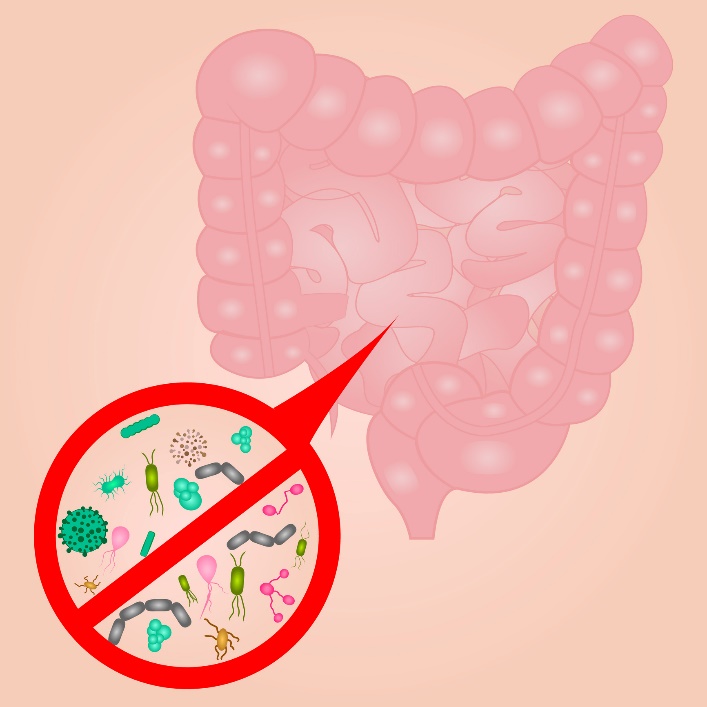 Excesul de creștere a bacteriilor din intestinul subțire (SIBO)