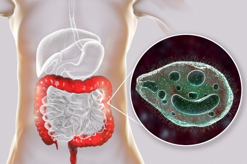 Balantidium coli - un parazit care infectează intestinul gros al tractului digestiv uman