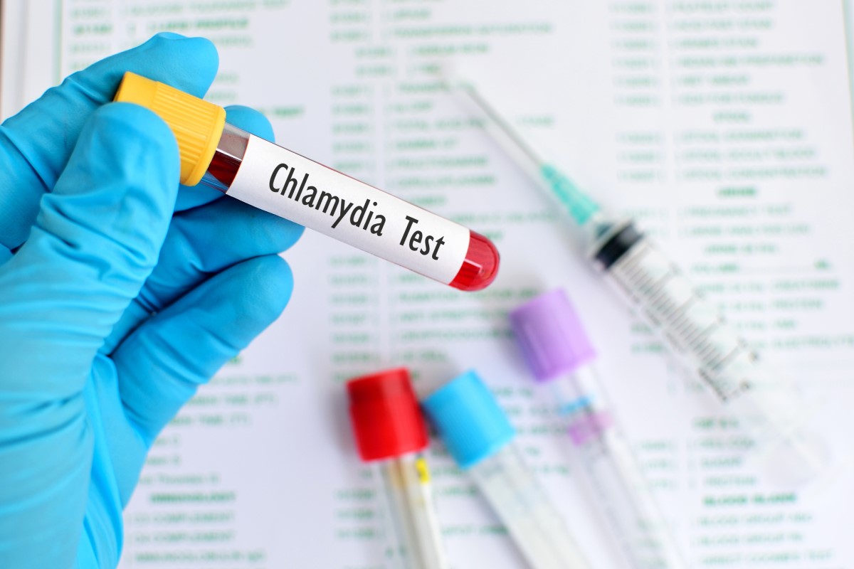 Test Chlamydia - sânge în eprubetă, mână înmănușată ținând eprubetă, eprubetă în fundal, ac