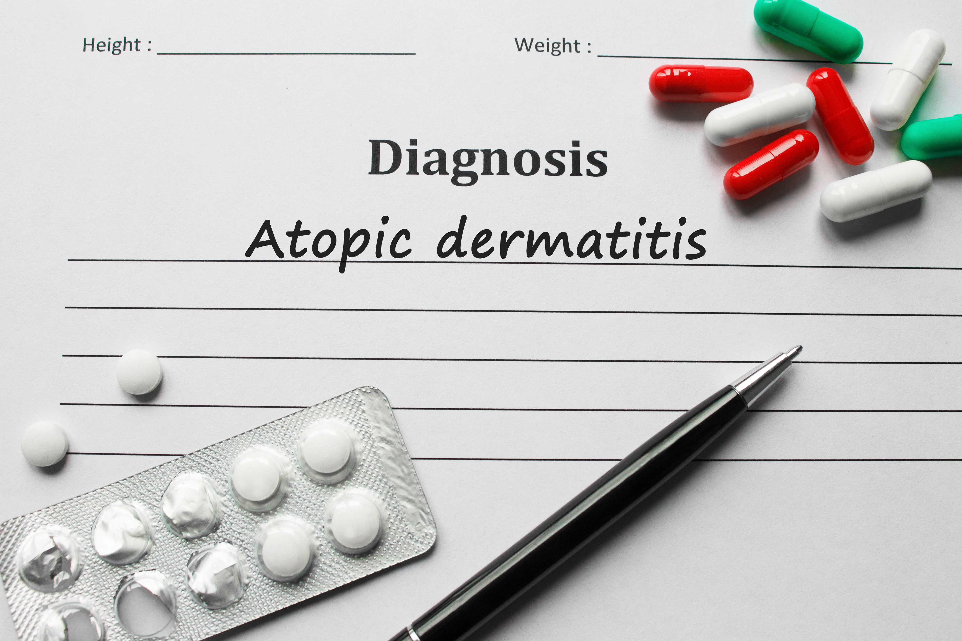 Diagnosticul dermatitei atopice