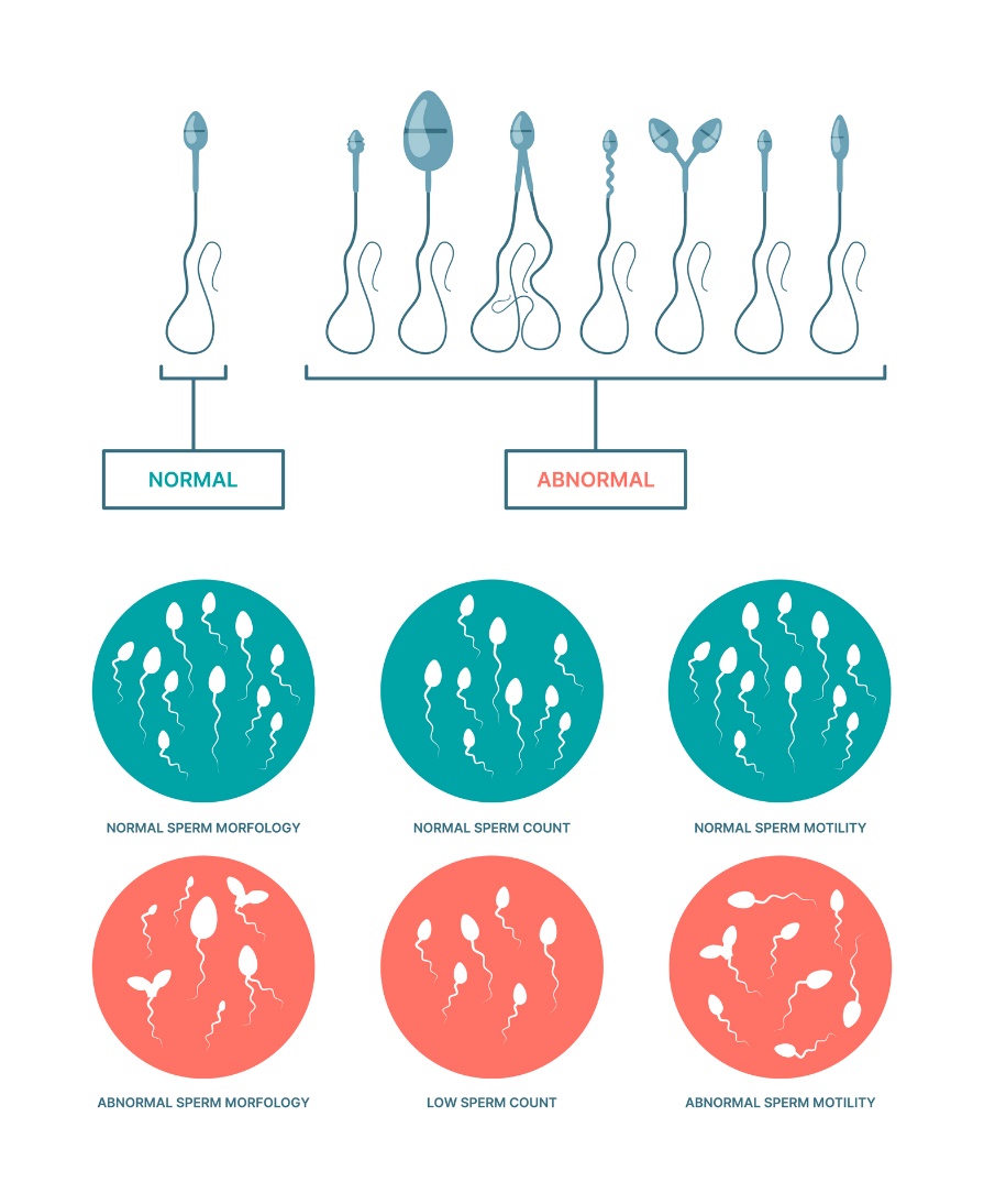 Starea fiziologică și anormală a spermatozoizilor. Morfologia, numărul și motilitatea spermatozoizilor.