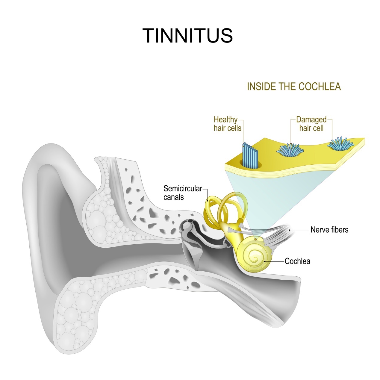 Urechea internă și tinitus - fluierături și bâzâituri în ureche