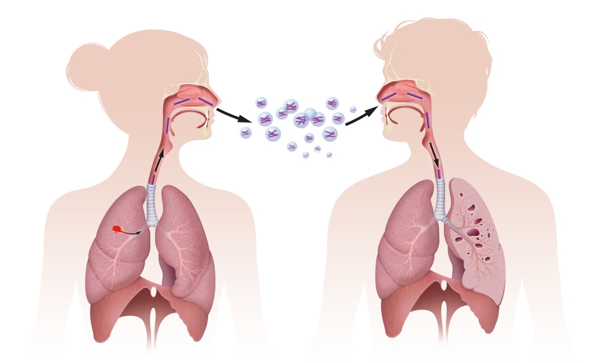 Transmiterea TB prin inhalare, adică prin inhalare, figura arată transmiterea prin inhalare.