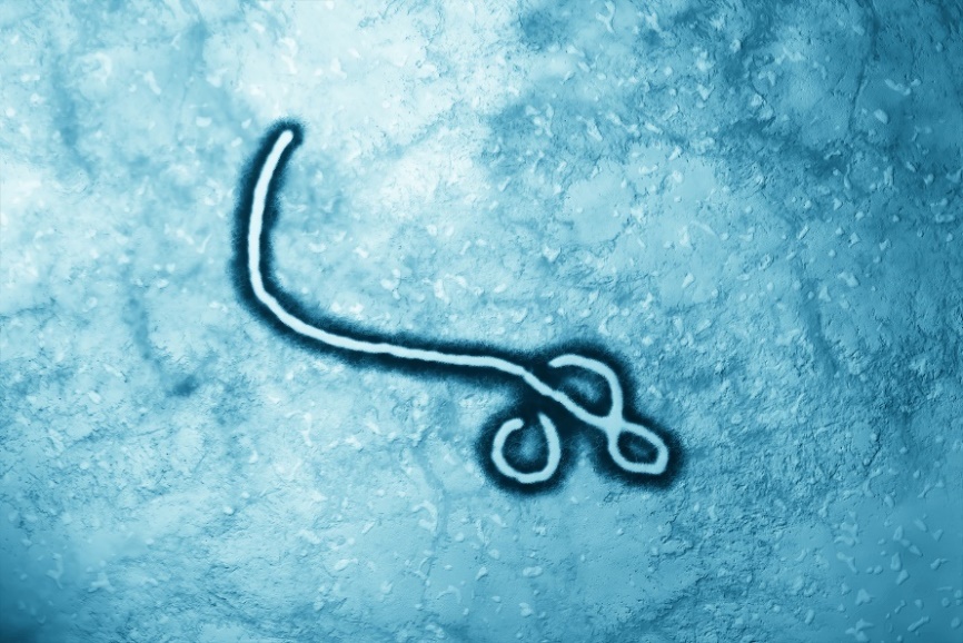 Virusul Ebola la microscop