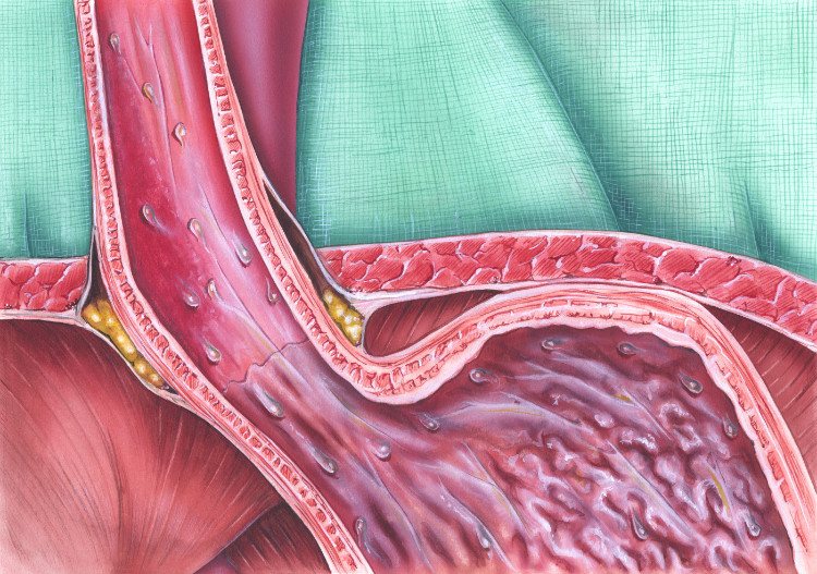 sfincterul descris anatomic pe esofag