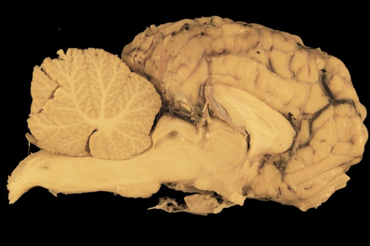 secțiune transversală de țesut cerebral