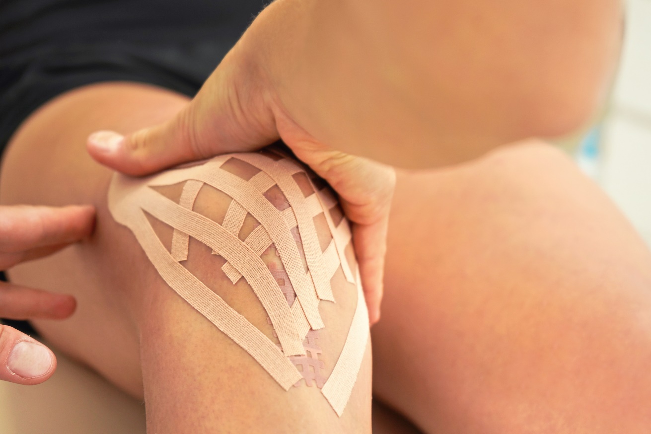 Kinesiotaping limfatic (lymphotape) aplicat în zona articulației genunchiului