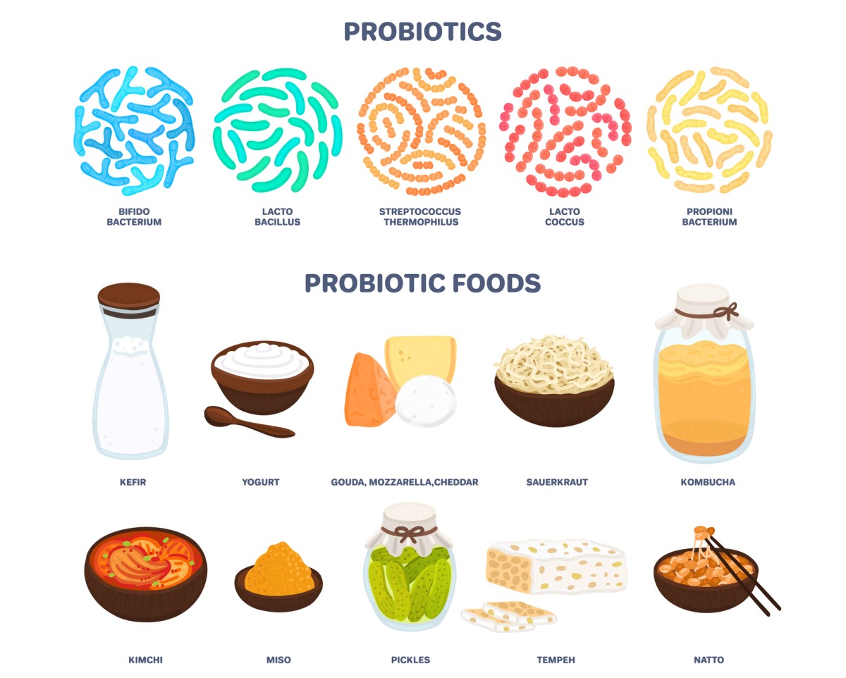 Probioticele: probioticele din alimentație care modifică echilibrul bacterian și funcția tractului digestiv - chefir, iaurt, brânză - gouda, mozzarella, cheddar, kombucha, kimchi, murături etc.