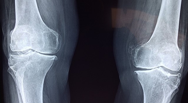 Radiografie a articulațiilor genunchiului