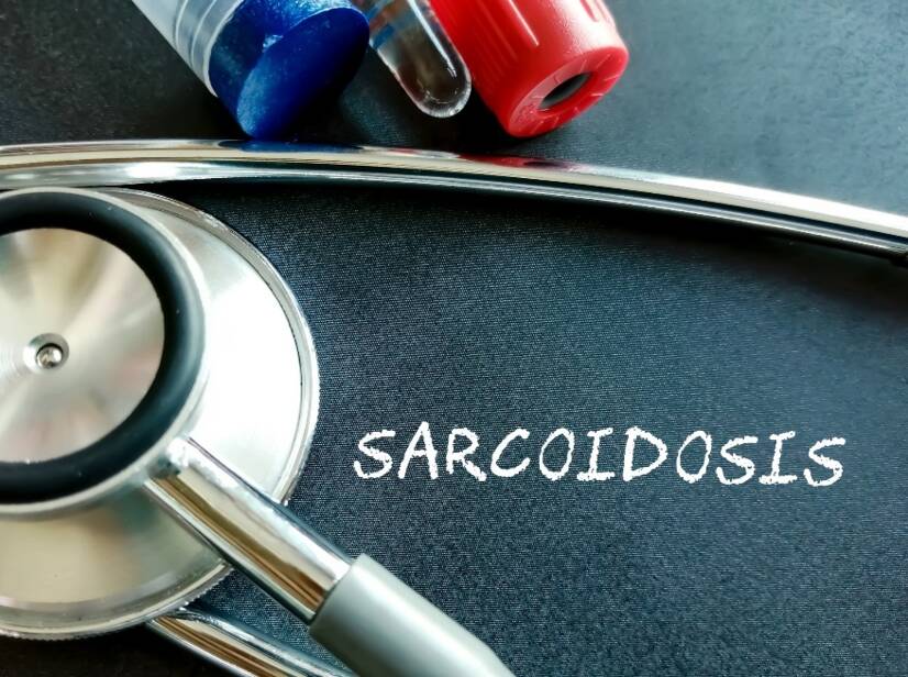 Sarcoidoza: Ce este sarcoidoza și care sunt cauzele/simptomele sale? Formele pulmonare și extrapulmonare