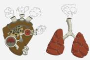 Hipertensiunea pulmonară: ce este și de ce apare? + Simptome și tratament